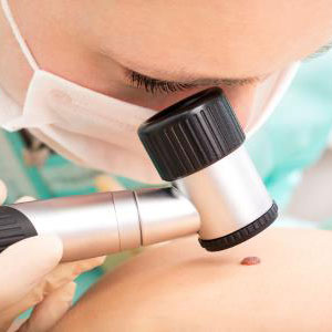Doctor checking skin cancer
