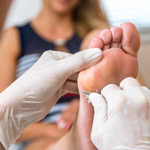Wart removal doctor in Huntington answers ‘Is wart removal expensive?’