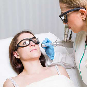 Facial Wart Removal from Dermatology & Cosmetic Laser Center