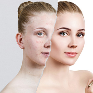 Skin Care Dermatology Near Me - nuevo skincare