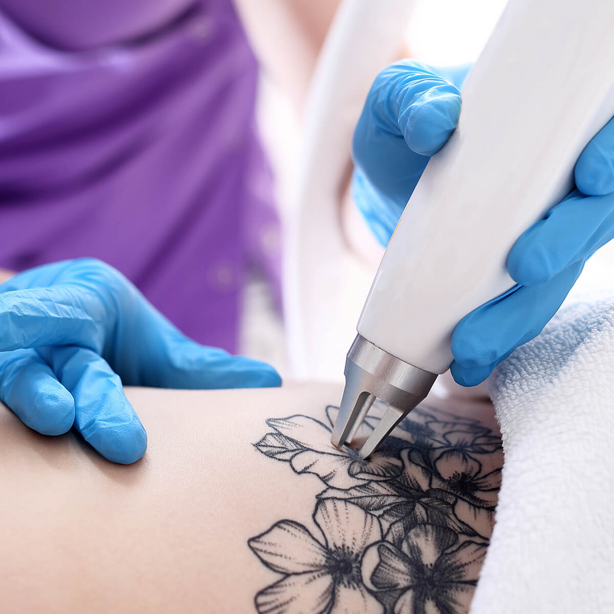 Tattoo Removal Scars at Dermatology & Cosmetic Laser Center in Huntington NY Area