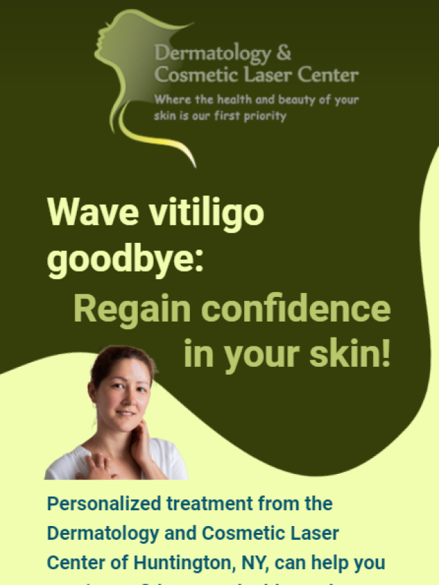 Wave vitiligo goodbye