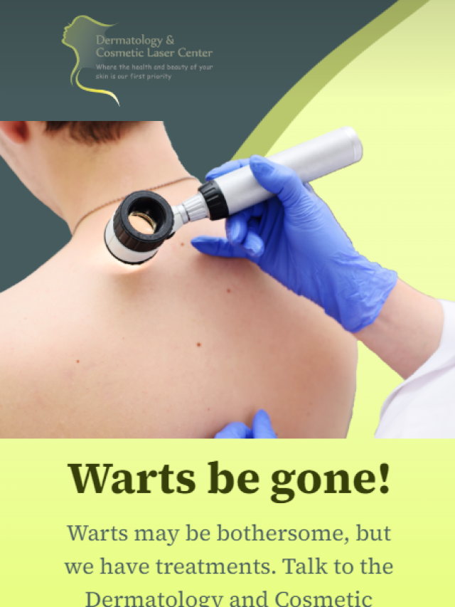 What are warts?